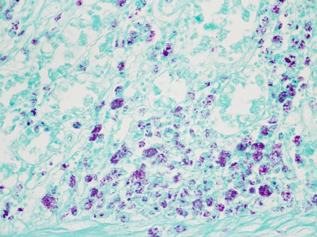 acid fast bacteria afb animal control histology slides newcomer
