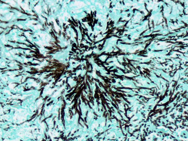 gms stain