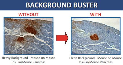 Back Ground Buster by Innovex Biosciences