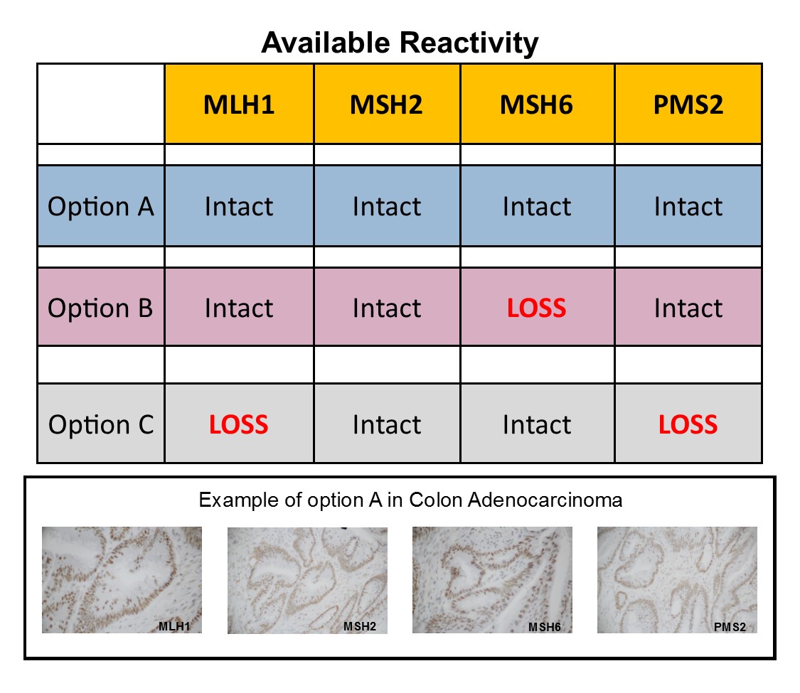 Mismatch Repair (MMR) Positive Control Slide in Large Intestine ...