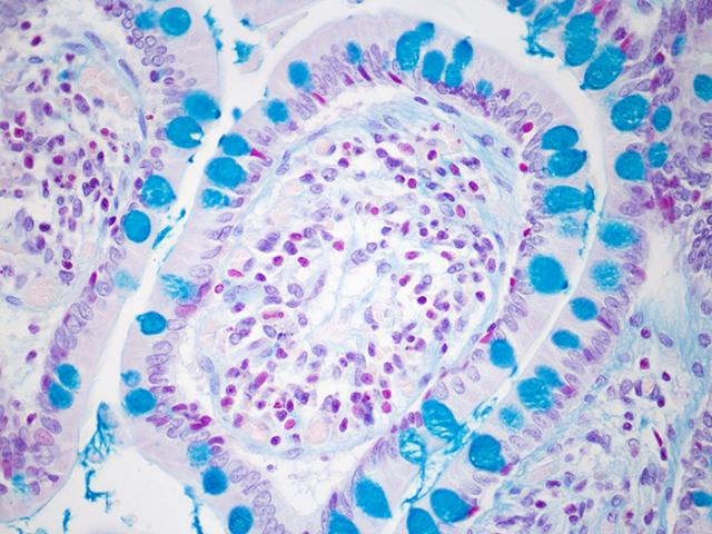 Alcian Blue Stain Kit - Newcomer Supply