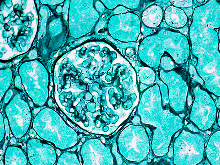 Histological Stain Kit Jones Basement Membrane