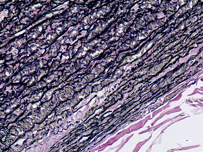 Histological Stain Kit Elastic, Verhoeff