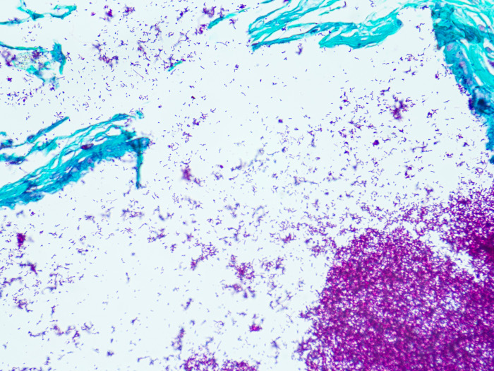 Histological Stain Kit AFB, Fite