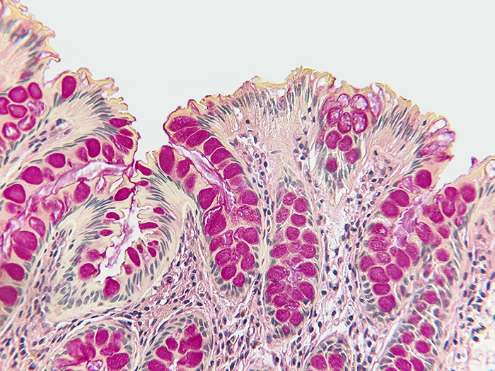 Histological Stain Kit Mucin, Mayer Mucicarmine