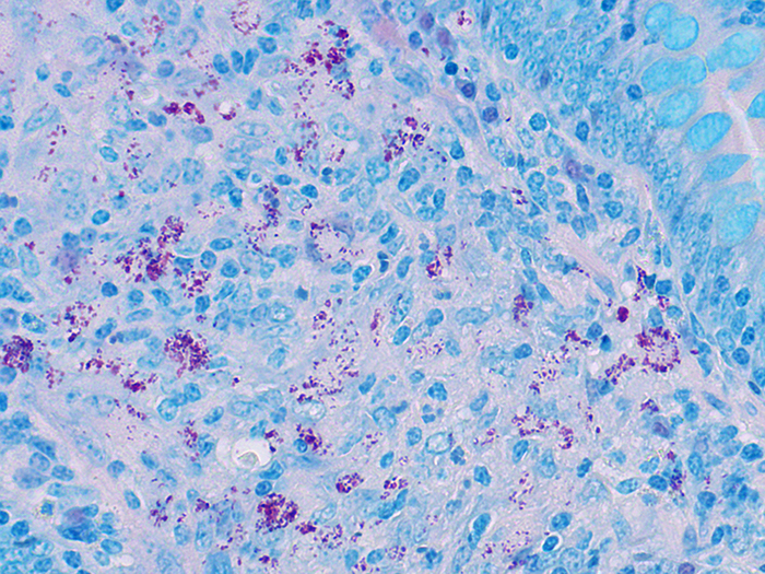 Histological Stain Kit AFB, Basic Fuchsin, Ellis & Zabrowarny