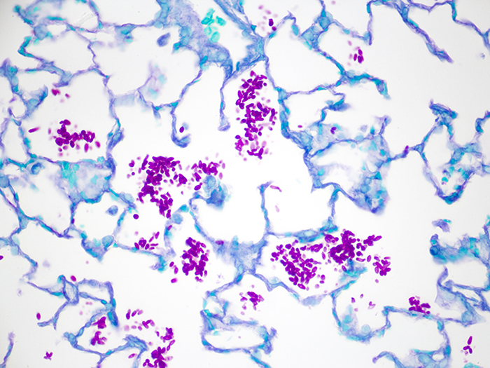 Histological Stain Kit Fungus, PAS/Light Green