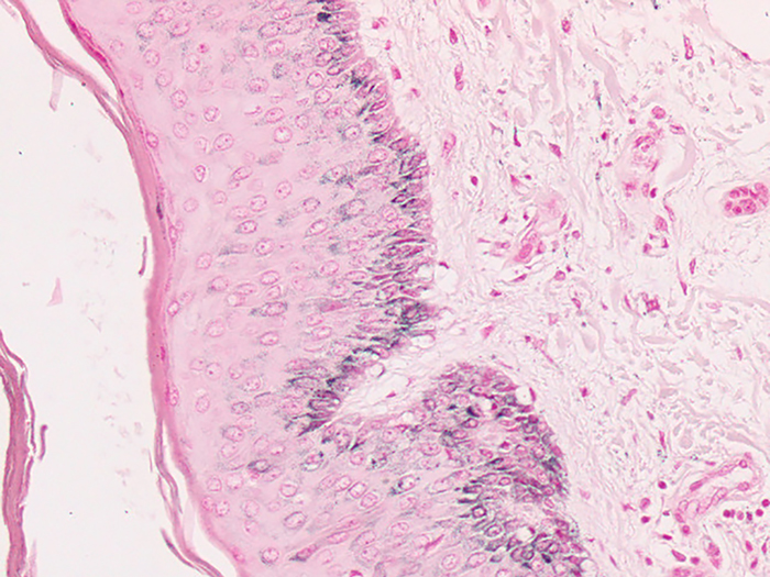 Histological Stain Kit Fontana Masson