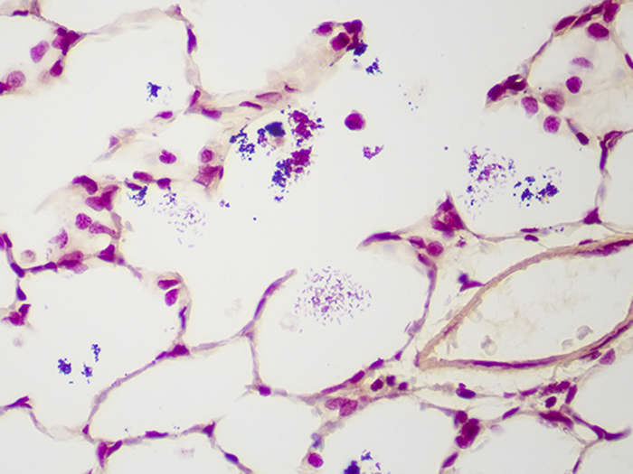 Histological Stain Kit Fungus, Gram, Brown-Hopps