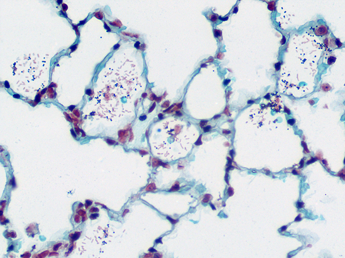 Histological Stain Kit Fungus, Gram, Hucker-Twort