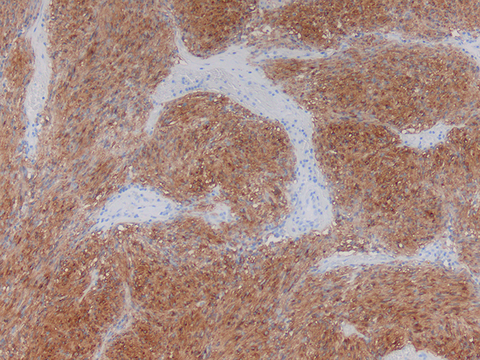 CD117, c-Kit Stained Histology Slide