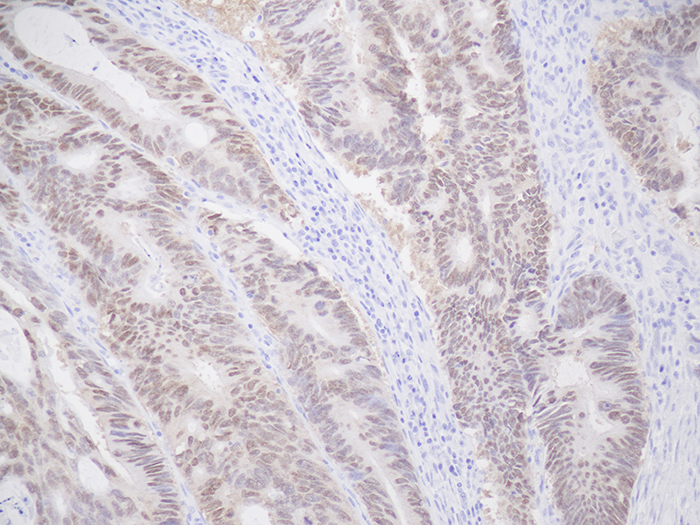 CDX2 Stained Histology Slide