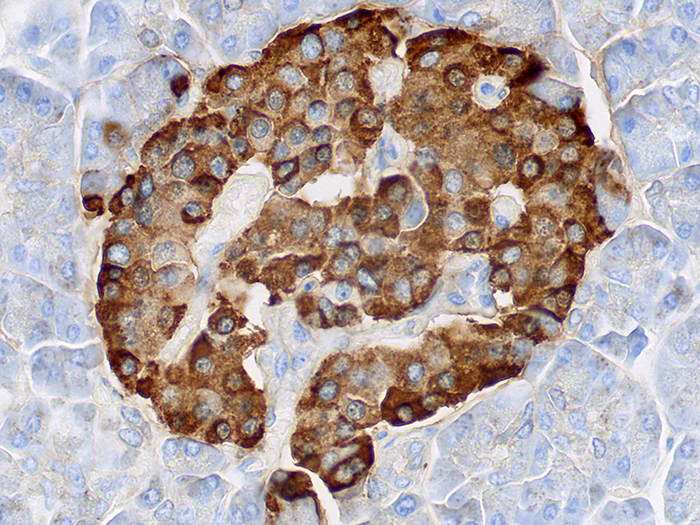 Chromogranin A Stained Histology Slide