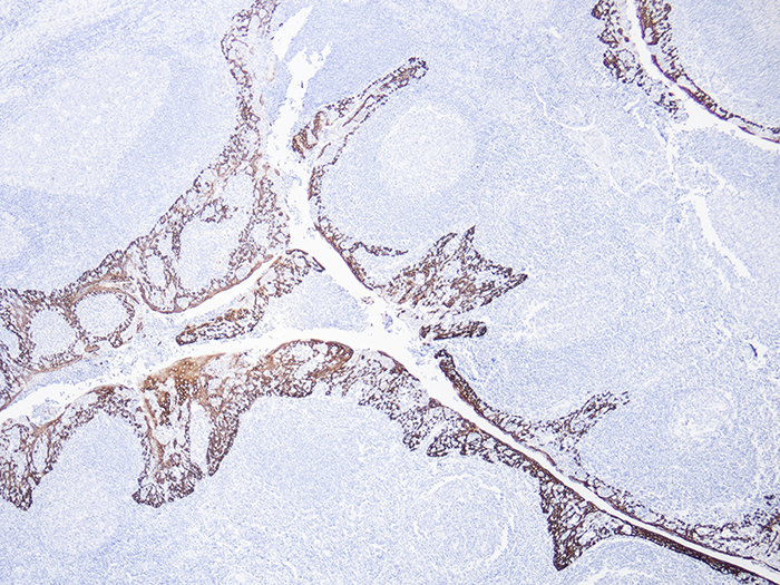 Cytokeratin 5 6 Ck5 6 Histology Control Slides