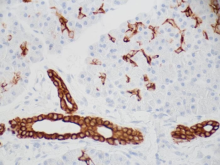 Cytokeratin 7 (CK7) Stained Histology Slide