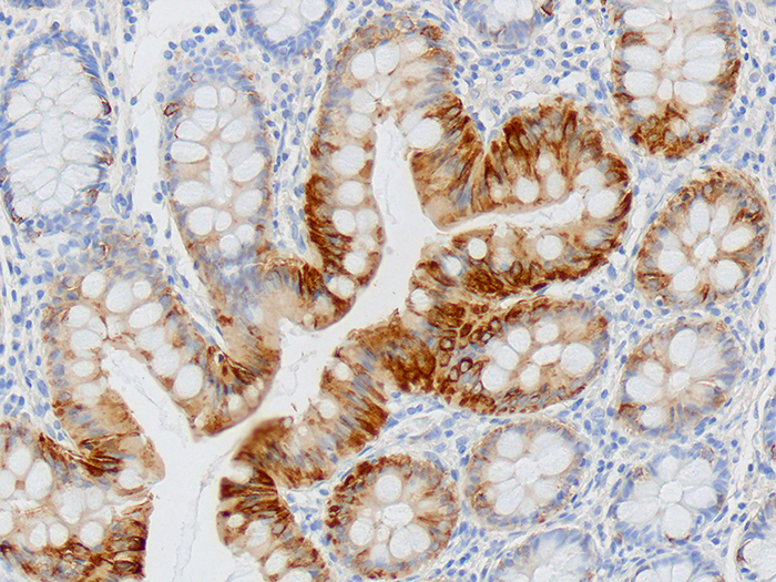 Cytokeratin 20 (CK20) Stained Histology Slide
