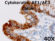 Cytokeratin AE1/AE3 Stained Histology Slide