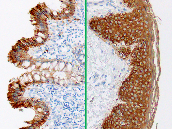 Cytokeratin AE1/AE3 Stained Histology Slide