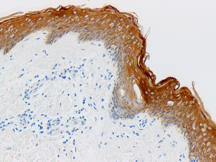 Cytokeratin, HMW Stained Histology Slide