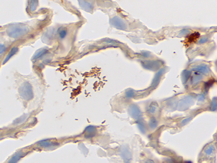 Helicobacter, Artificial Stained Histology Slide