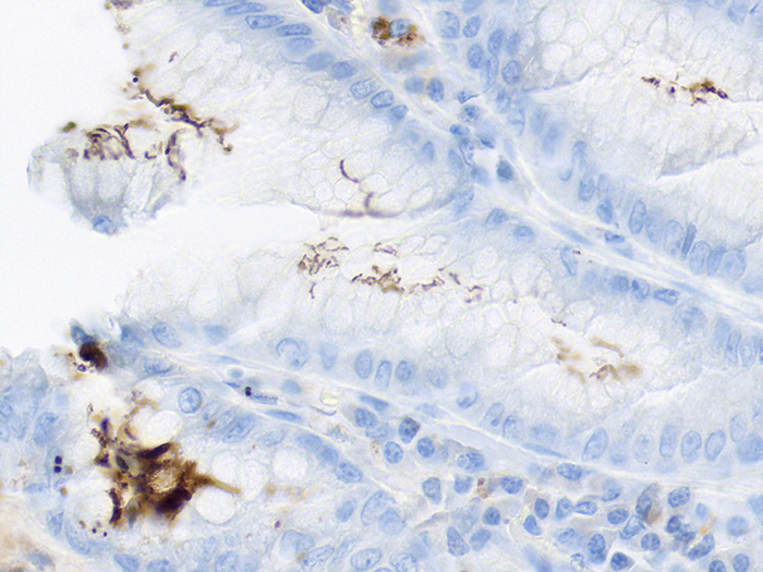 Helicobacter sp, Animal Stained Histology Slide