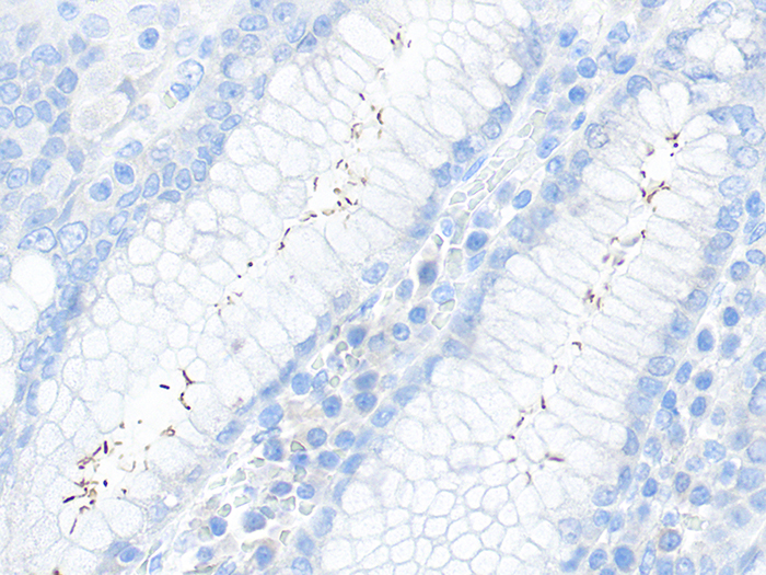 Helicobacter Stained Histology Slide
