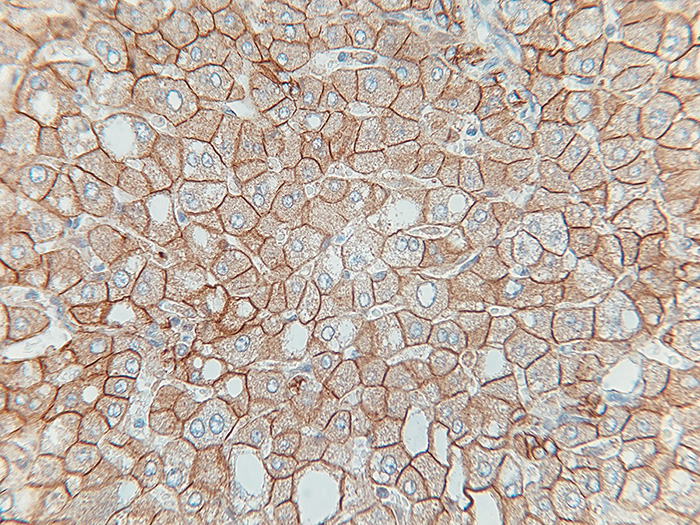 E-cadherin Stained Histology Slide