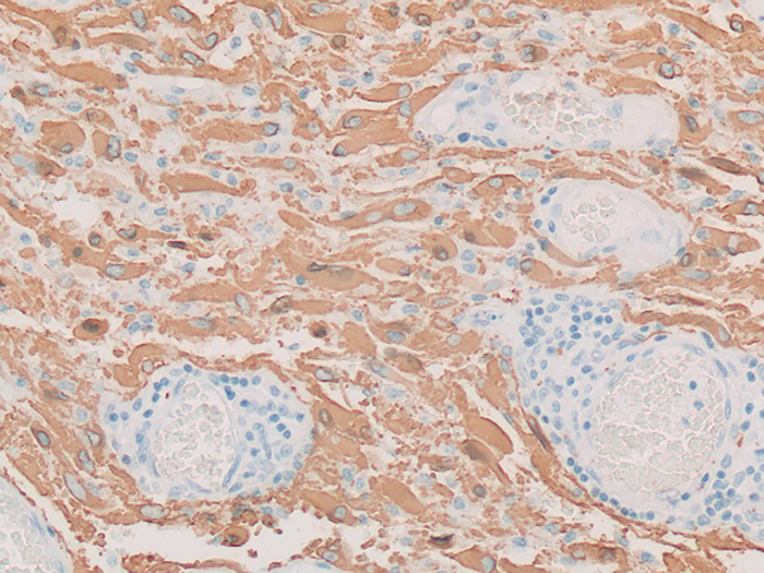 Glial Fibrillary Acidic Protein (GFAP) Stained Histology Slide