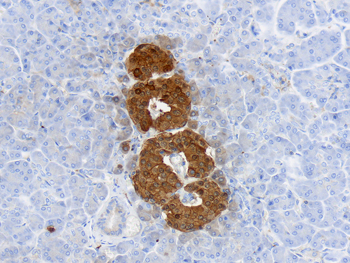 Neuron-Specific Enolase (NSE) Stained Histology Slide