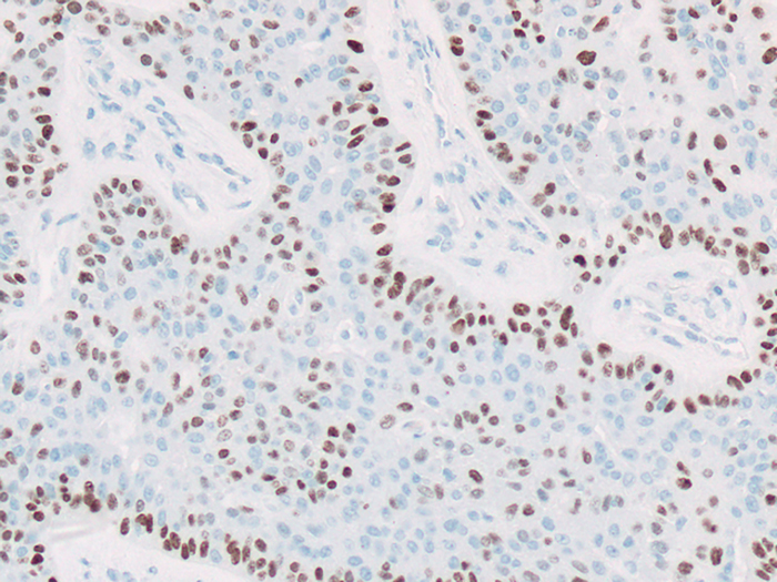 p40 Stained Histology Slide