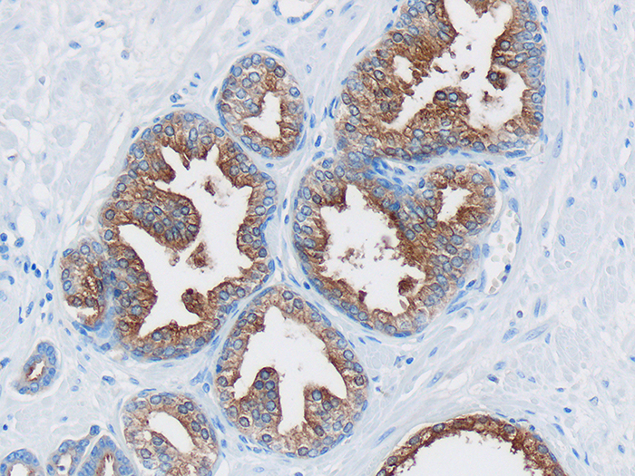 Prostate Specific Antigen (PSA) Stained Histology Slide