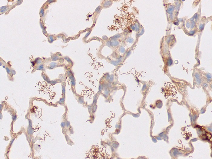 Spirochete Treponema, Artificial Stained Histology Slide