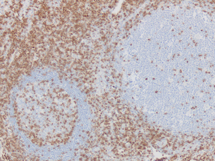 CD3, T-cell Stained Histology Slide