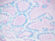 Alcian Blue pH 2.5, Goblet Cell Stained Histology Slide