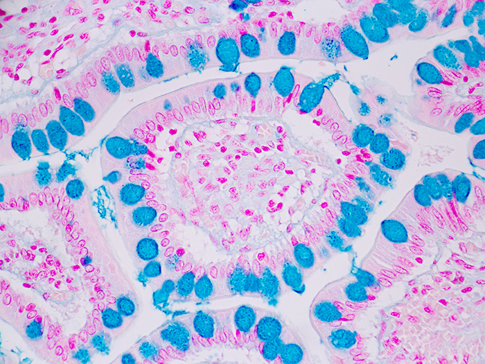 Alcian Blue pH 2.5, Goblet Cell Stained Slide