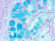 Alcian Blue pH 2.5, Barrett's Esophagus Stained Histology Slide