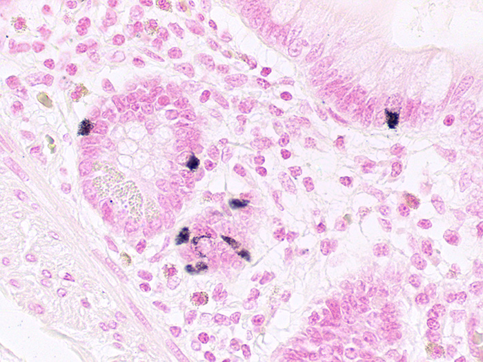 Argentaffin Stained Histology Slide