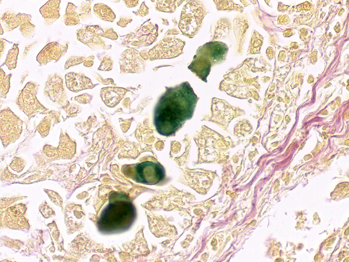 Bile Stained Histology Slide