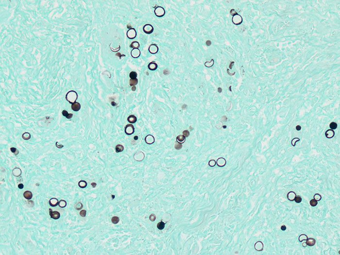 Blastomyces Stained Histology Slide