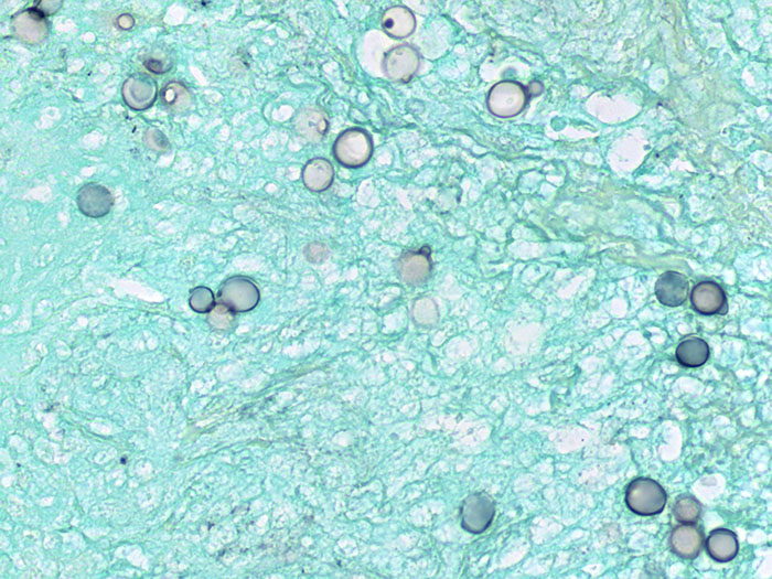 Blastomyces sp., Animal Stained Histology Slide