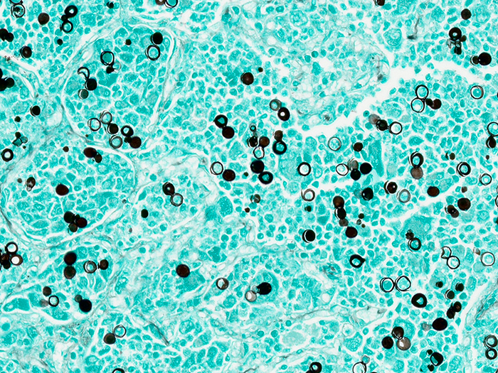 Blastomyces, Animal Stained Histology Slide