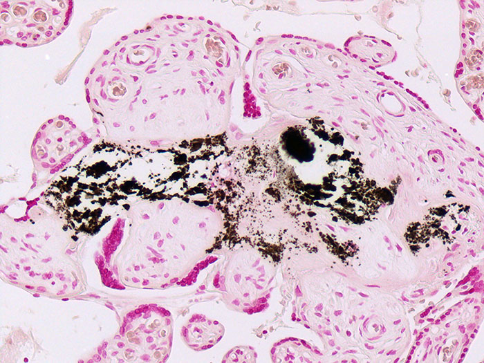 Calcium Stained Histology Slide