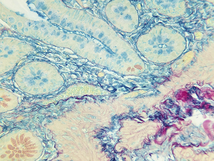 Colloidal Iron Stained Histology Slide