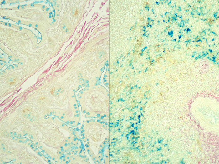 Colloidal Iron, Multi-Tissue Stained Histology Slide
