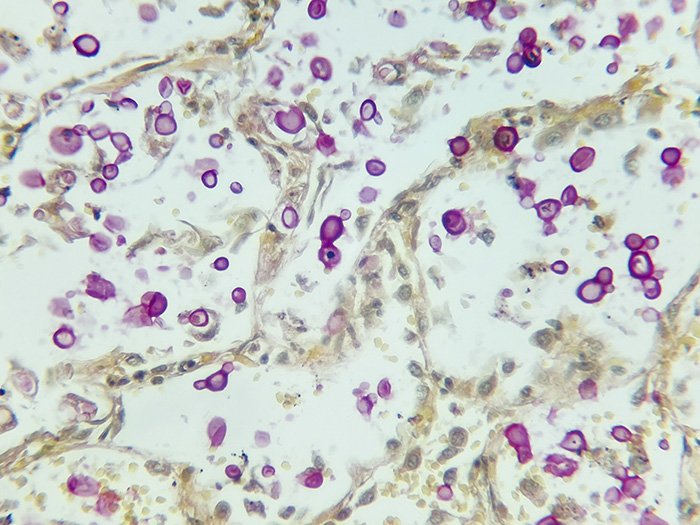 Cryptococcus Stained Histology Slide