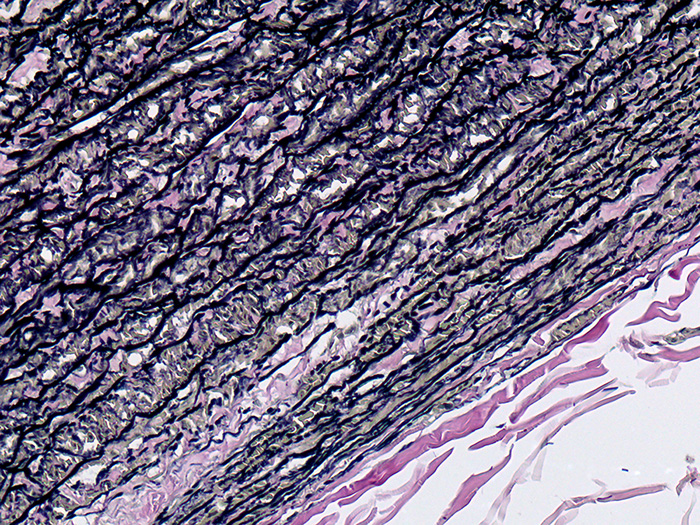 Elastic, Aorta Stained Histology Slide