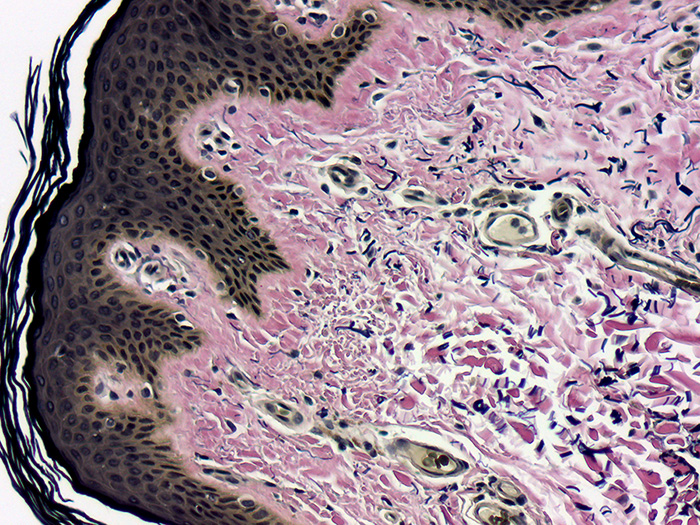 Elastic, Skin Stained Histology Slide