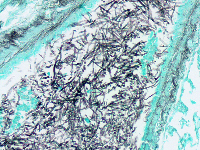 Fungus, GMS, Aspergillus sp., Artificial Stained Histology Slide