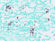 Fungus, GMS, Candida sp., Artificial Stained Histology Slide
