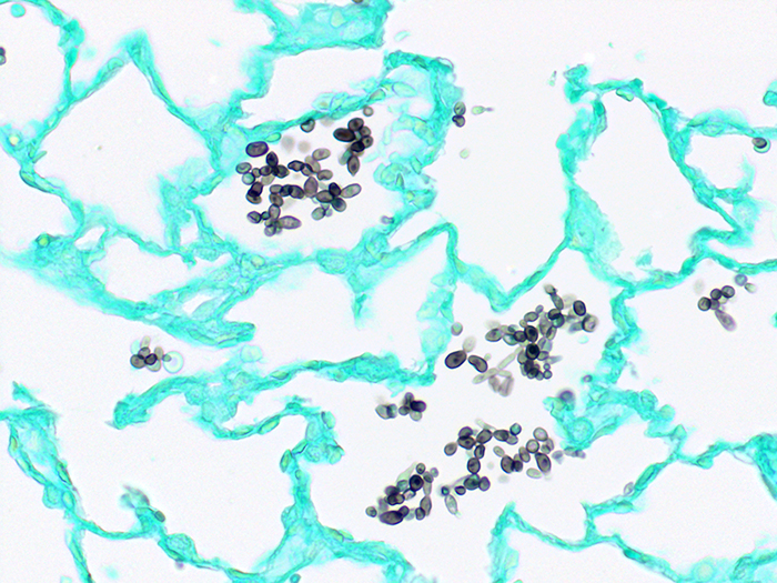 Fungus, GMS, Candida, Artificial Stained Histology Slide